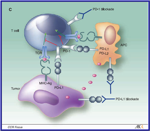 Pd lcancer